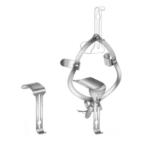 O’Sullivan-O’Connor